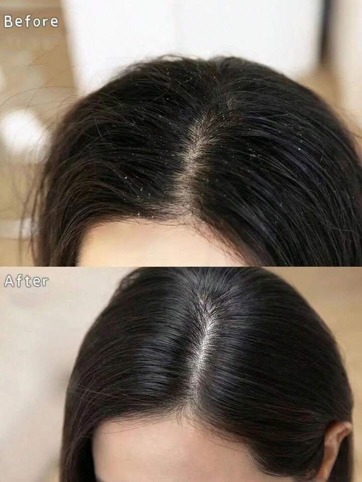 شامپو سیمبیوس چرب