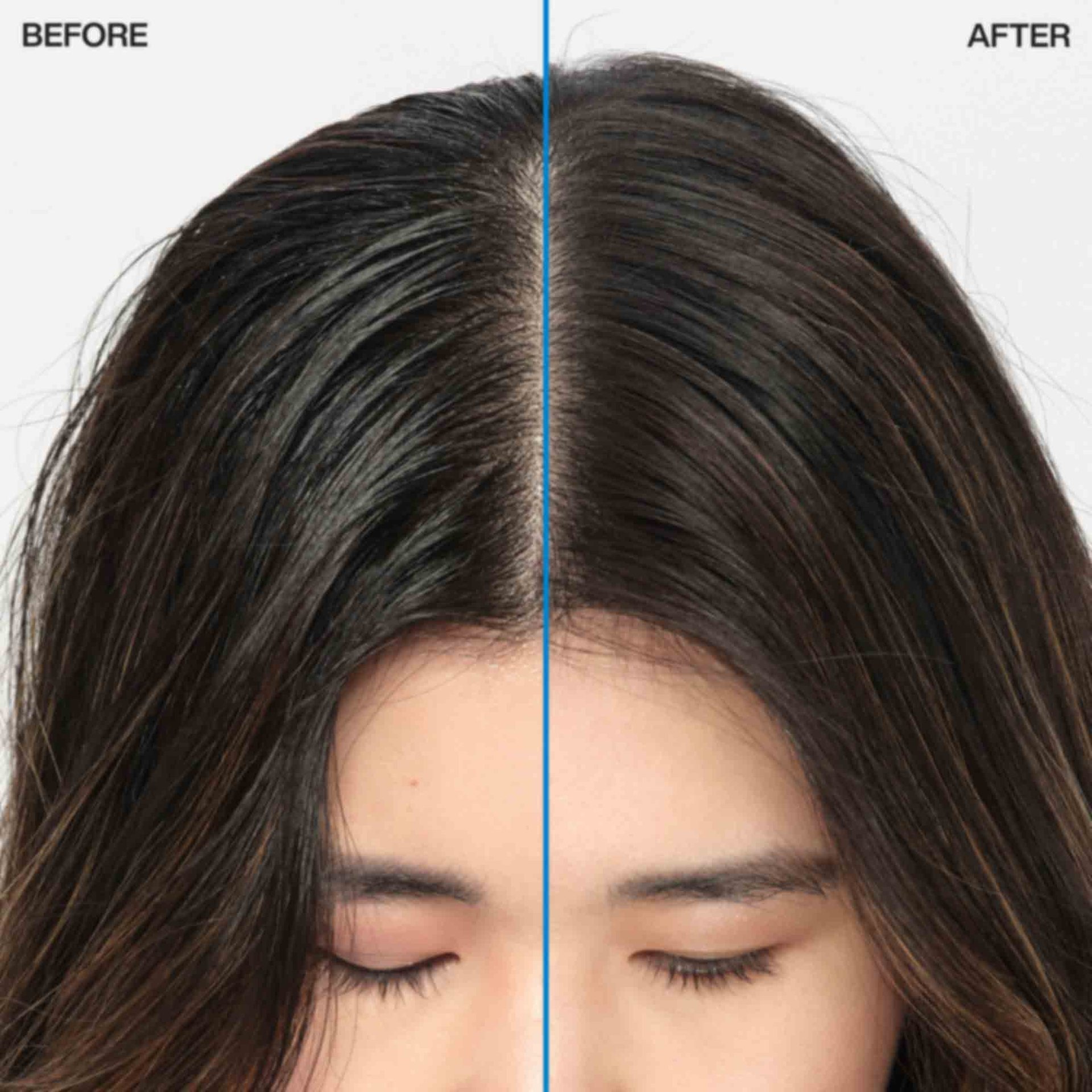 شامپو خشک ردکن